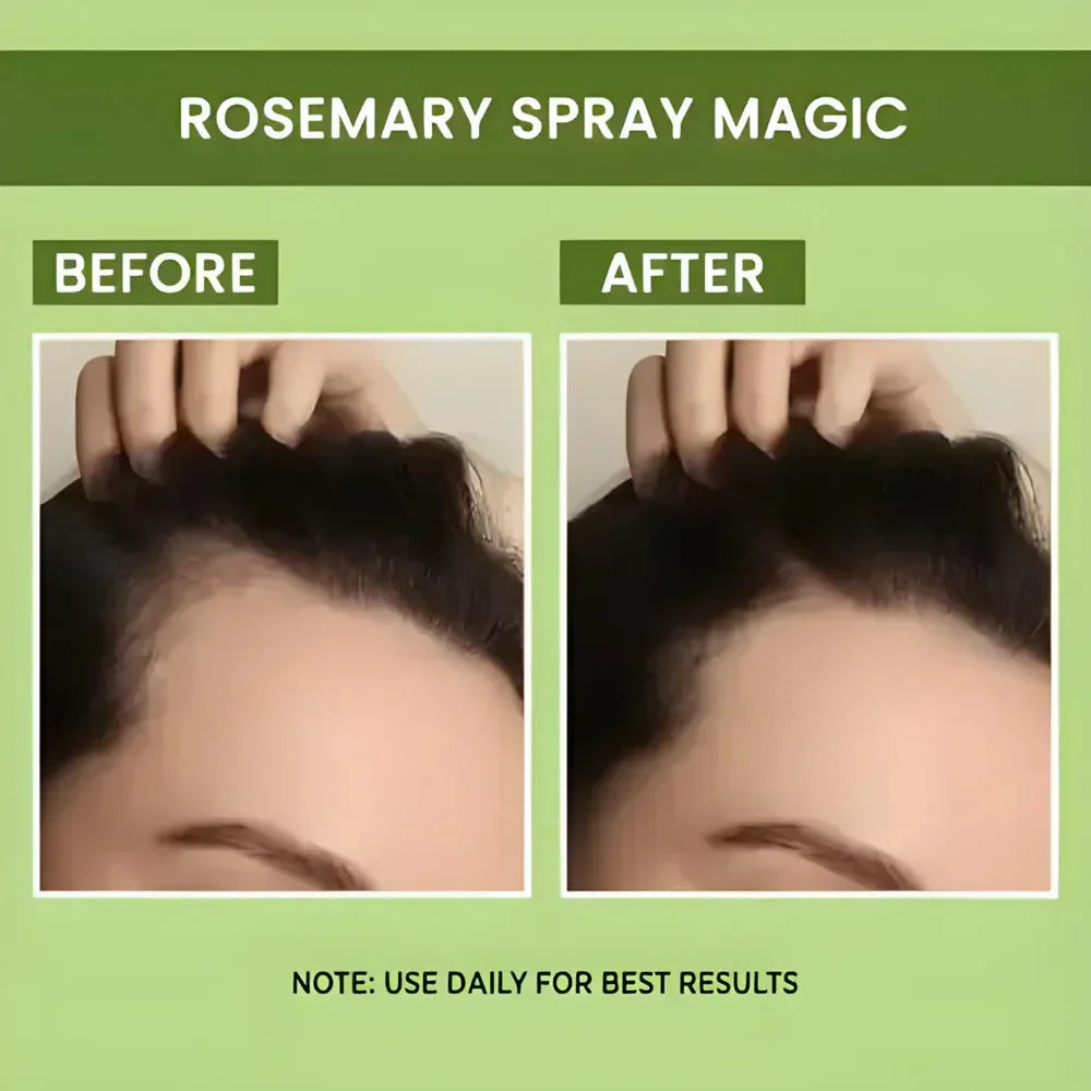 Rosemary Water Spray | For Hair Regrowth (Buy 1 Get 2 Free 😍)